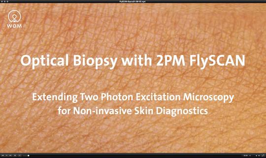 Film New Imaging Technique for Diagnosis